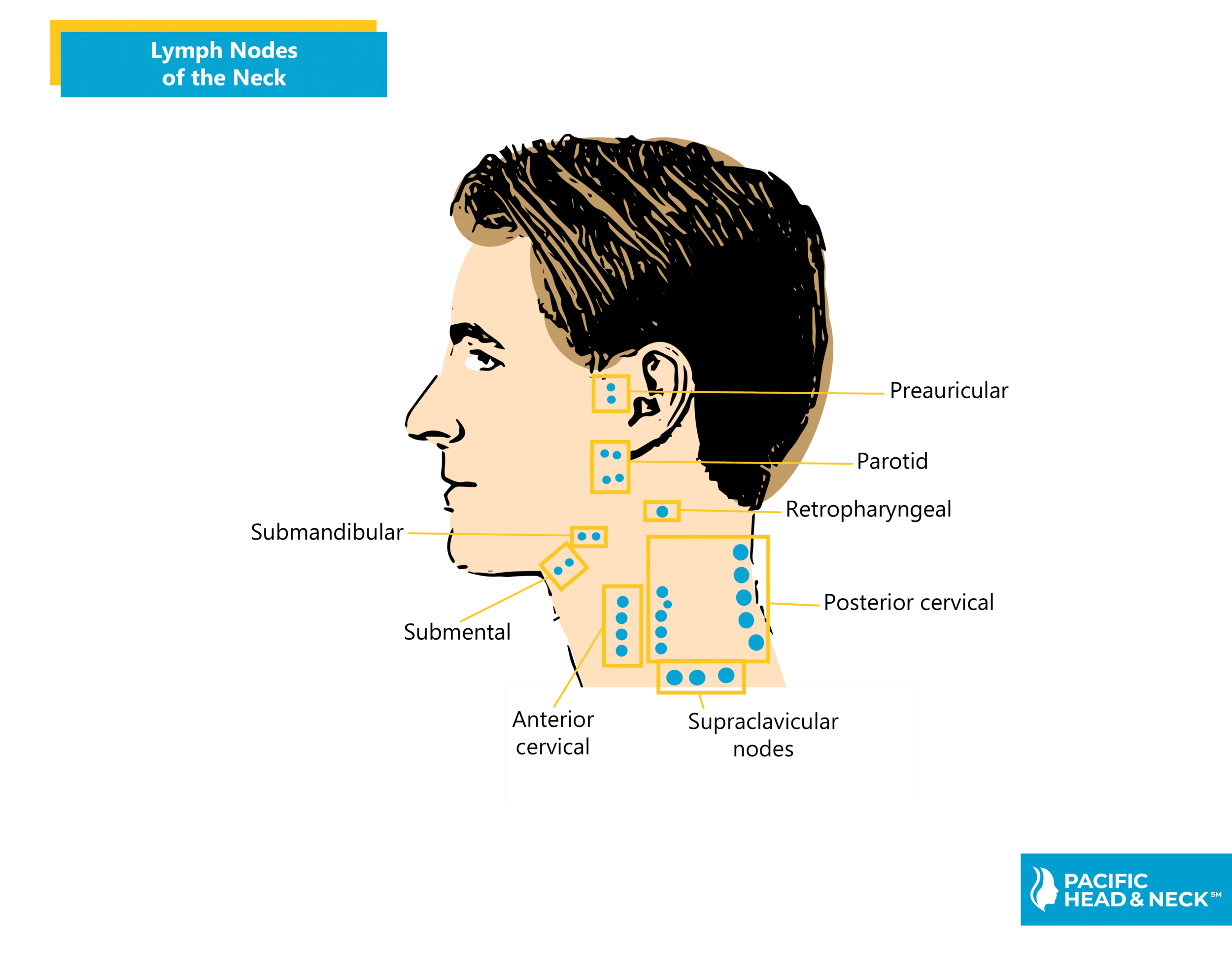 pain on lymph node back of head